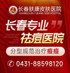 长春肤康皮肤病医院看诊腮边痘反复长是什么原因